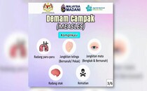 Apa Itu Ruam Measles